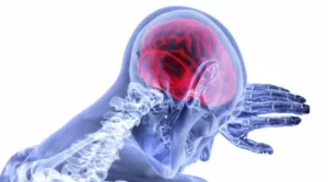 Dokter Tekankan Pentingnya Nutrisi untuk Otak pada Pemulihan Stroke