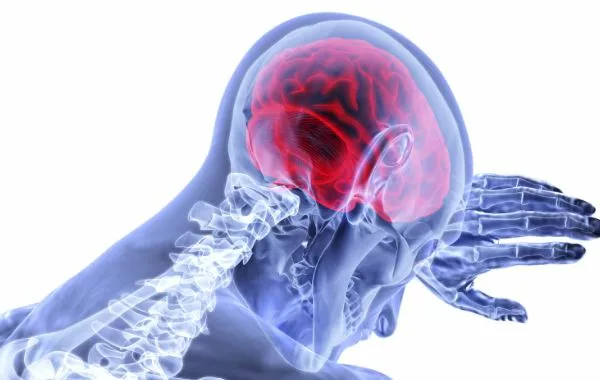 Dokter Tekankan Pentingnya Nutrisi untuk Otak pada Pemulihan Stroke